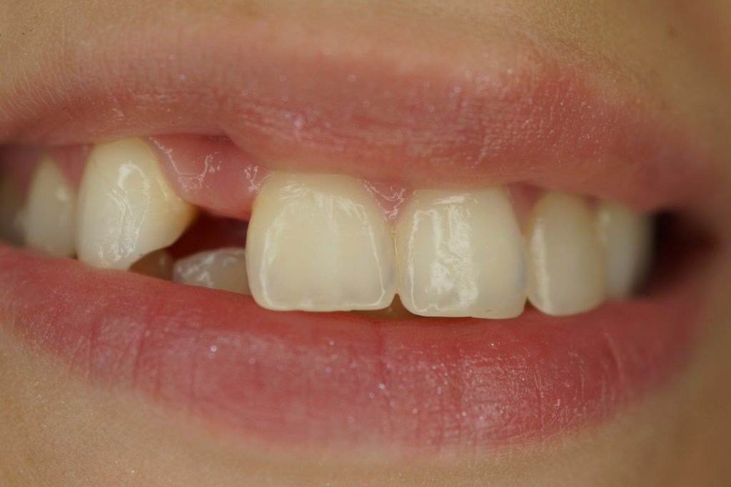 Minimalnie inwazyjne metody leczenia