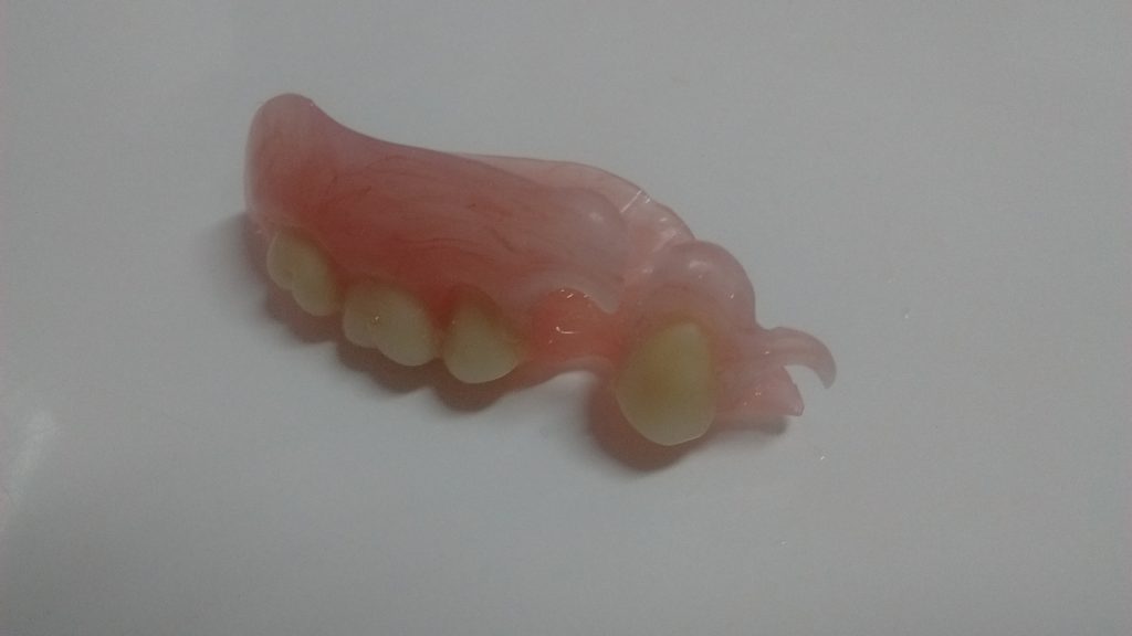 uzupełnienie braków zębowych