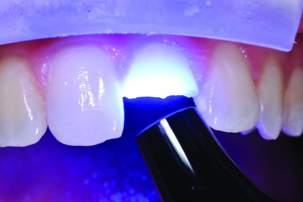 zastosowanie bioaktywnych podkładów