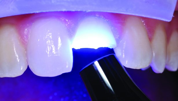 zastosowanie bioaktywnych podkładów