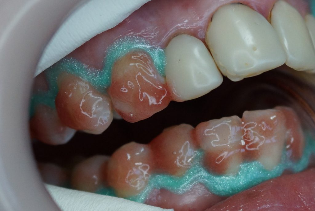 Estetyczna rehabilitacja