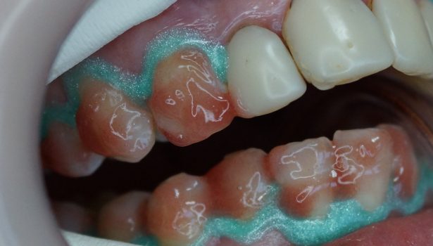 Estetyczna rehabilitacja