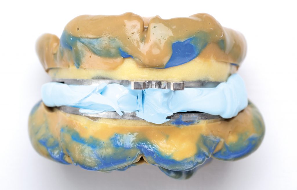 Ulepszona estetyka dziąseł