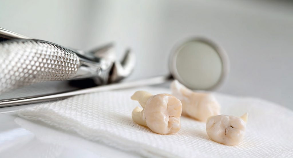 Zastosowanie preparatów srebra w stomatologii