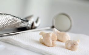 Zastosowanie preparatów srebra w stomatologii