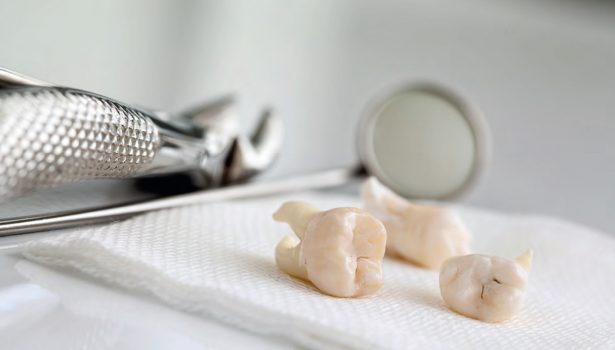 Zastosowanie preparatów srebra w stomatologii