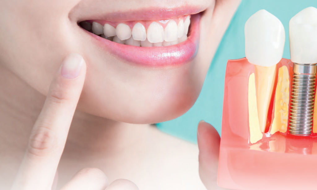 TPS_4_2018_Krótkie implanty jako alternatywa dla nadleczenia