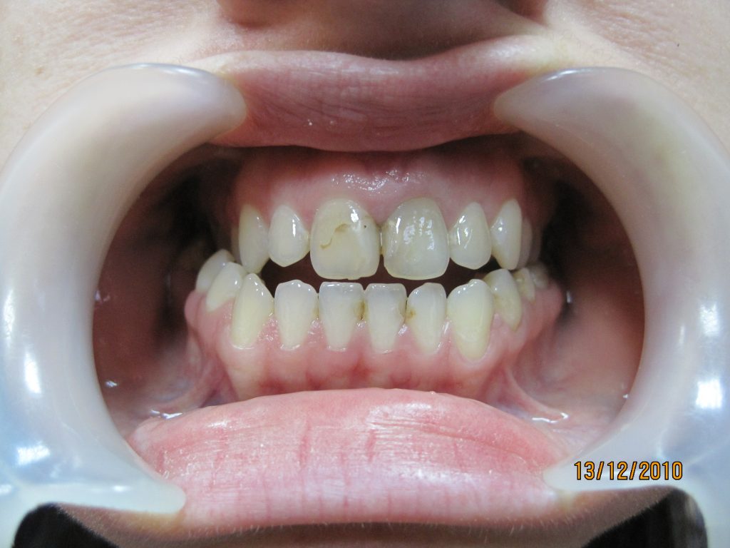 Leczenie interdyscyplinarne