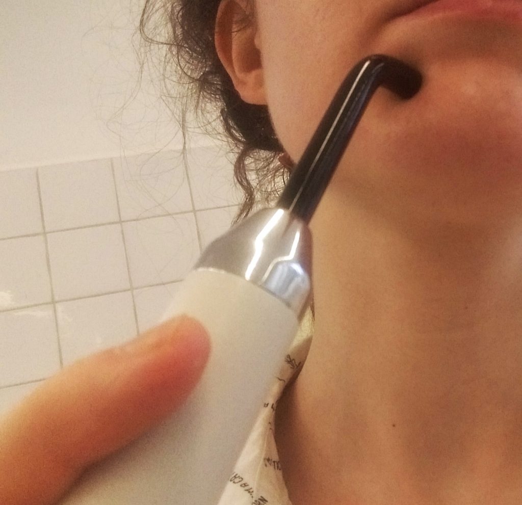 Regeneracja nerwu zębodołowego dolnego