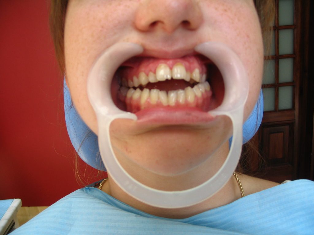 współpraca z chirurgiem szczękowym