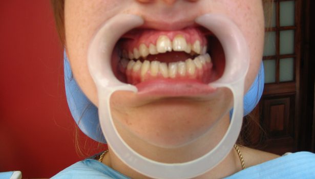 współpraca z chirurgiem szczękowym