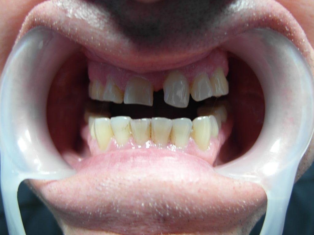 Przygotowanie ogólnostomatologiczne