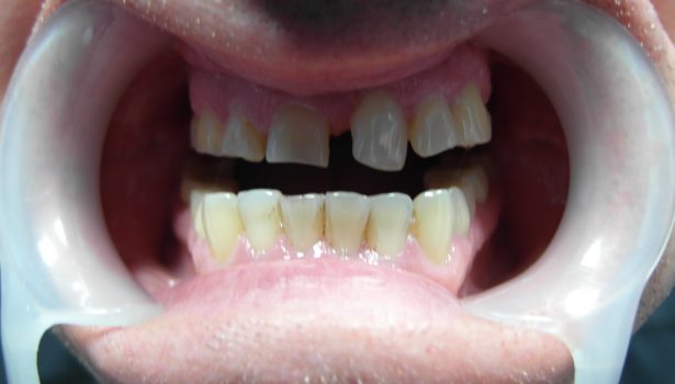 Przygotowanie ogólnostomatologiczne