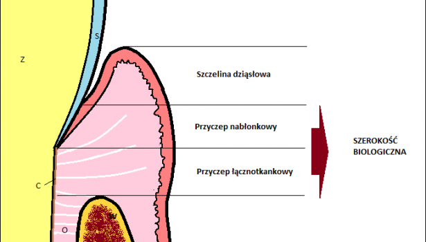 Ryc. 1. Schemat budowy przyzębia: Z – zębina, S – szkliwo, C – cement, O – ozębna, W – kość wyrostka zębodołowego