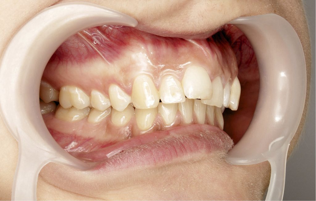 tps-7-8-2019-miniimplanty-fot.1