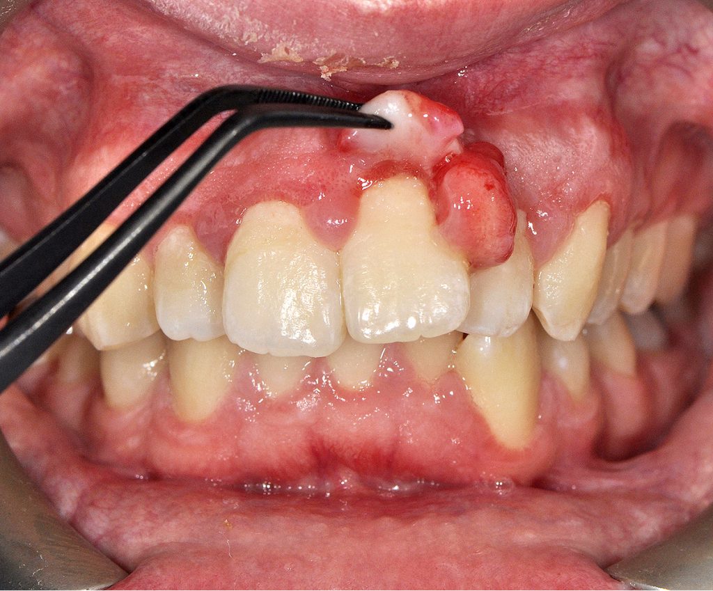 tps-7-8-2019-nadziąślak-fot.4