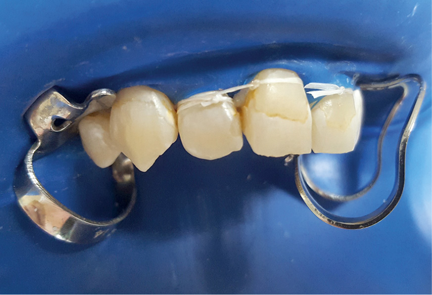 tps-9-2019-icon-vestibular-fot.1