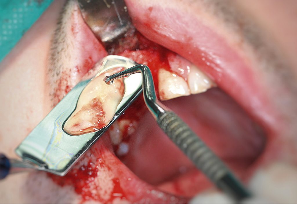 tps-9-2019-autogenne metody-fot.7