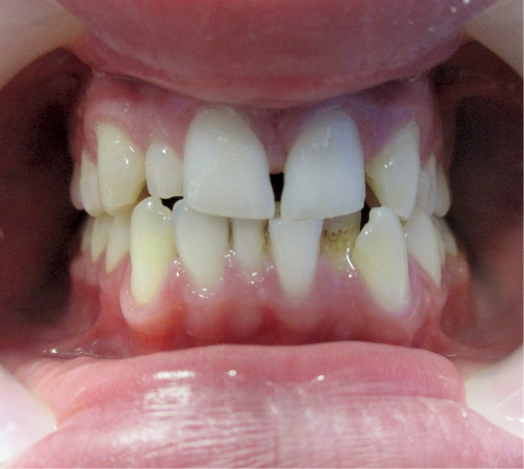 przygotowanie ortodontyczne