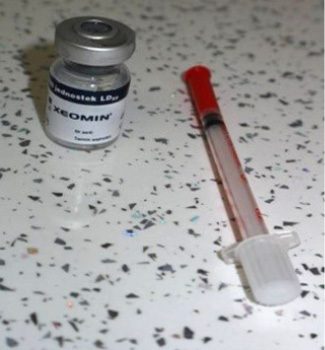 zastosowanie toksyny botulinowej