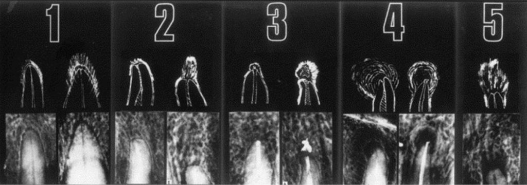 tps-7-8-2019-zmiany-okołowierzchołkowe-fot.1