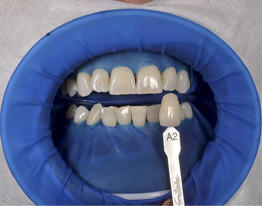 tps-7-8-2019-wybielanie-fot.4