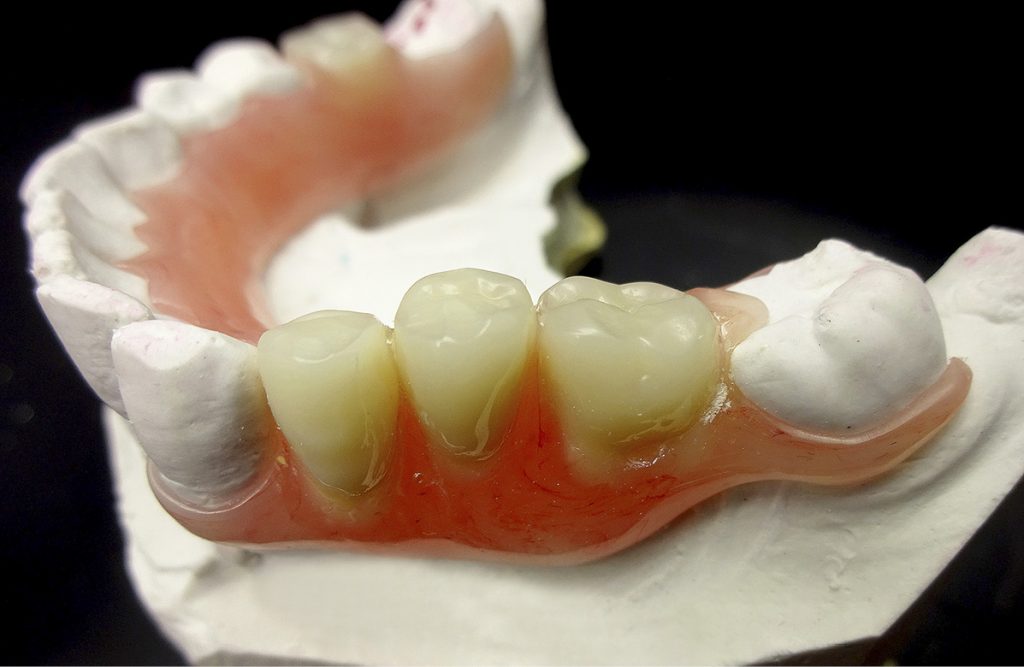 tps-9-2019-FJP-Pressing-Dental-fot.1