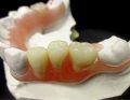 tps-9-2019-FJP-Pressing-Dental-fot.1