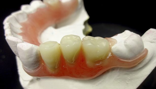 tps-9-2019-FJP-Pressing-Dental-fot.1