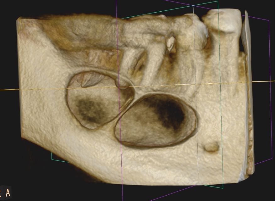 tps-9-2019-torbiele-kosci-fot.1