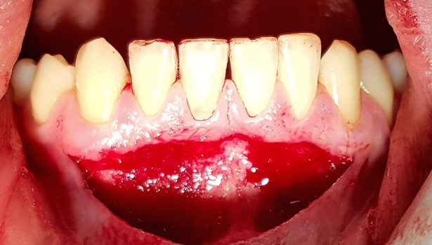 tps-9-2019-fotobiomodulacja-fot.1