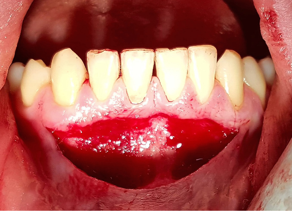 tps-9-2019-fotobiomodulacja-fot.1