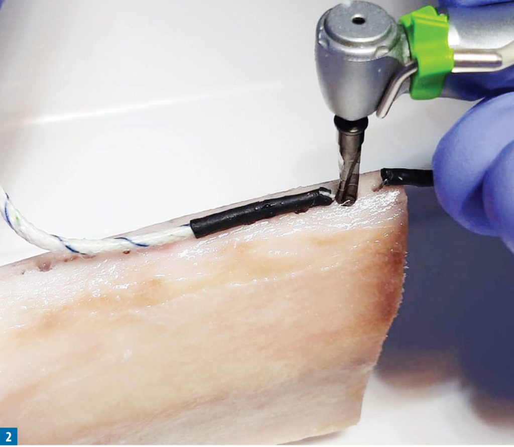 TPS_3_20_WPLYW_WIERTLA_IMPLANTOLOGICZNEGO_NA_WZROST_TEMPERATURY_FOT_2