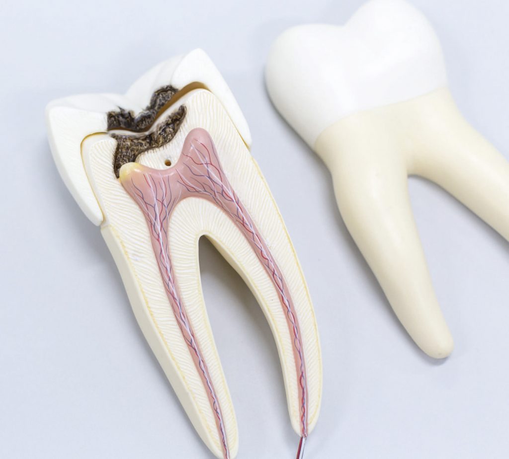 Odbudowa zęba po leczeniu endodontycznym; fot. istockphoto
