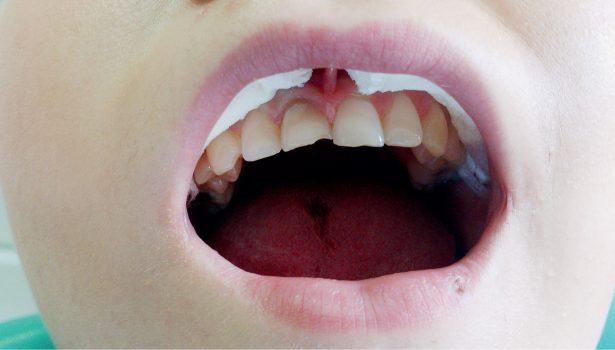 Leczenie przy użyciu tradycyjnych metod