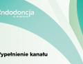 wypełnienie kanału