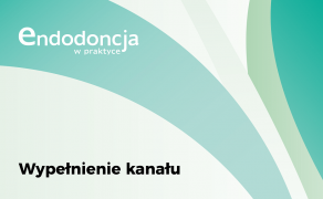 wypełnienie kanału