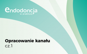 opracowanie kanału zęba