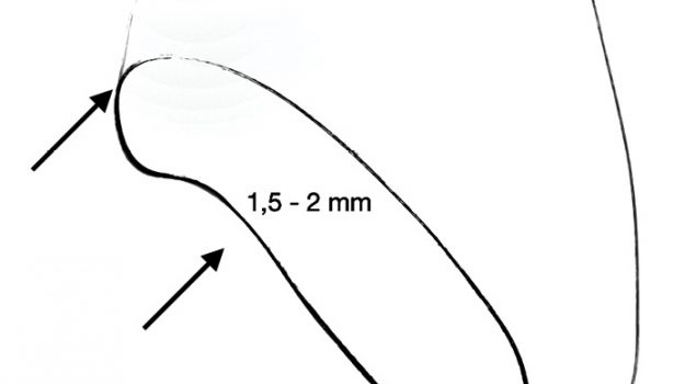 nowoczesna stomatologia rekonstrukcyjna
