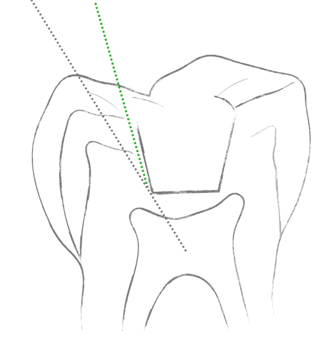 TPS_6_20_stomatologia_zachowawczaNOWOCZESNA_STOMATOLOGIA_REKONSTRUKCYJNA_RYS_2