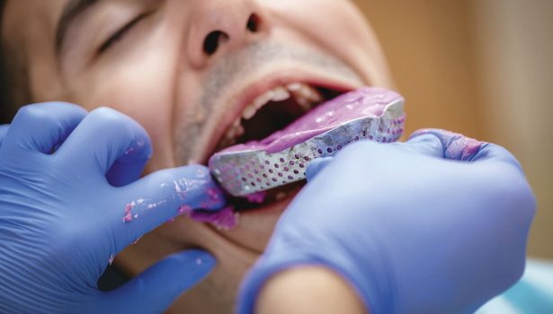 zęby do protez; fot. istockphoto