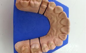 Wykonawstwo laboratoryjne wkładów koronowych