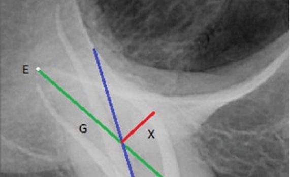 leczenie endodontyczne zębów