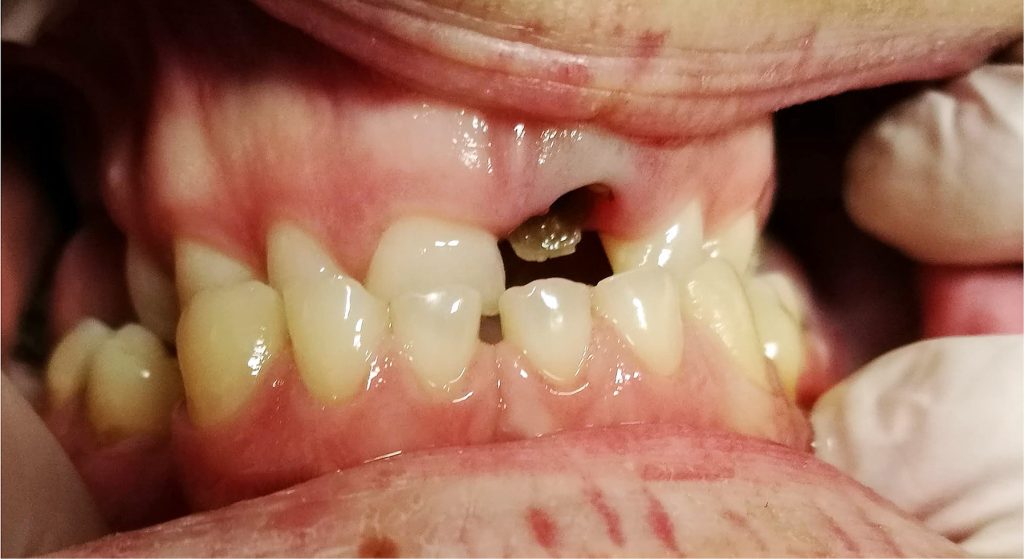 TPS_7-8_20_protetyka_i_dysfunkcje_ZASTOSOWANIE_TOKSYNY_BOTULINOWEJ_FOT_1