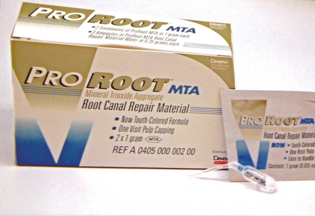 Mineral Trioxide Aggregate