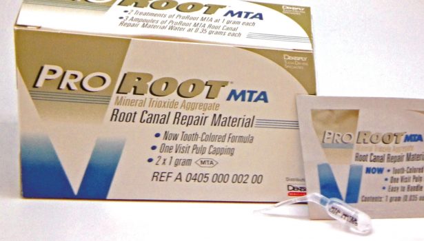 Mineral Trioxide Aggregate