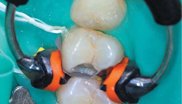 TPS_1-2_17_temat_numeru_ODBUDOWA_KLASY_II_OD_W_ZEBIE_PRZEDTRZONOWYM_FOT_2