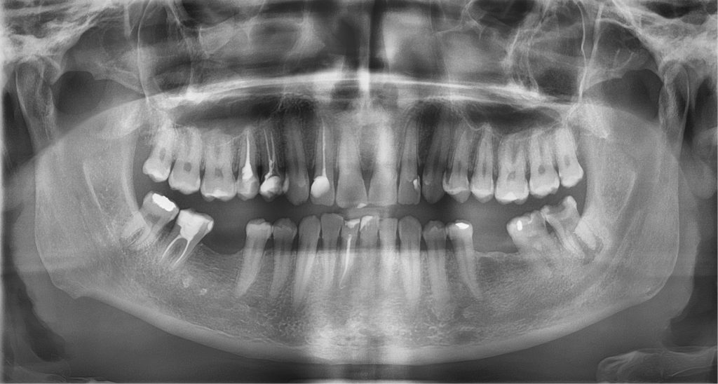 TPS_1-2_17_badania_interdyscyplinarne_ROLA_LEKARZA_DENTYSTY_W_ROZPOZNAWANIU_CUKRZYCY_FOT_1