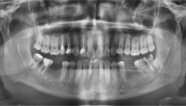 TPS_1-2_17_badania_interdyscyplinarne_ROLA_LEKARZA_DENTYSTY_W_ROZPOZNAWANIU_CUKRZYCY_FOT_1