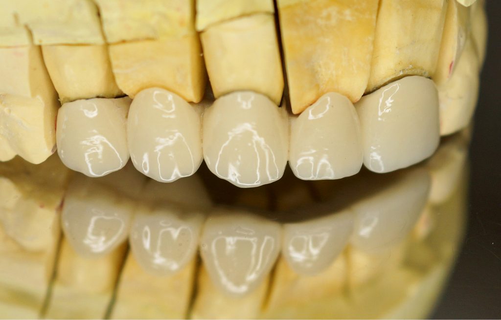 TPS_1-2_17_protetyka_SZEROKOSC_BIOLOGICZNA_PRZYZEBIA_FOT_8